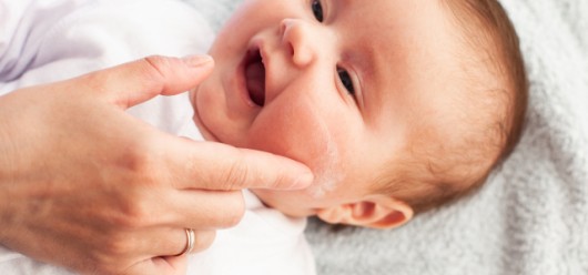 Ατοπική Δερματίτiδα σε βρέφη: 6+1 tips για να ανακουφίσουμε άμεσα το δερματάκι του μωρού μας - Featured Image