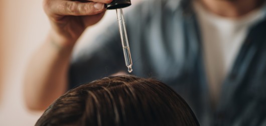 Τριχόπτωση: Γιατί πεφτουν τα μαλλιά μου και πώς μπορω να το σταματήσω; - Featured Image