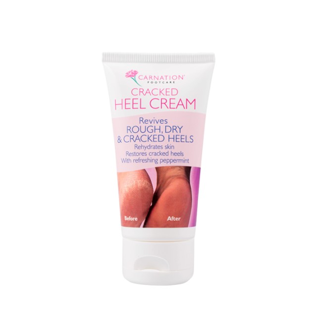 Carnation Footcare Cracked Heel Cream Κρέμα για Ξηρές Φτέρνες, 50ml